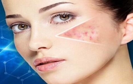 昆明祛痘效果最好的美容醫(yī)院推薦！