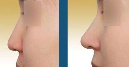 西安哪家皮膚美容機(jī)構(gòu)做得好？