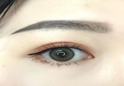 鄭州激光理哪家醫(yī)院好？解析鄭州市新興激光理療醫(yī)院評價與潛力