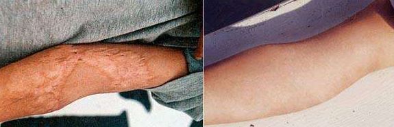 北京下顎骨手術(shù)哪家好？全面解析北京市優(yōu)質(zhì)下顎骨手術(shù)醫(yī)院及醫(yī)生推薦