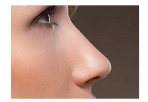 昆明狐臭求治，哪家醫(yī)院治療效果好？