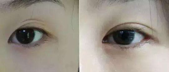 南京哪家假體豐胸醫(yī)院好？醫(yī)術(shù)精湛、效果明顯的南京豐胸專科醫(yī)院推薦