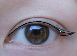 2023昆明隆胸整形哪家醫(yī)院好？專家推薦與真實案例一覽