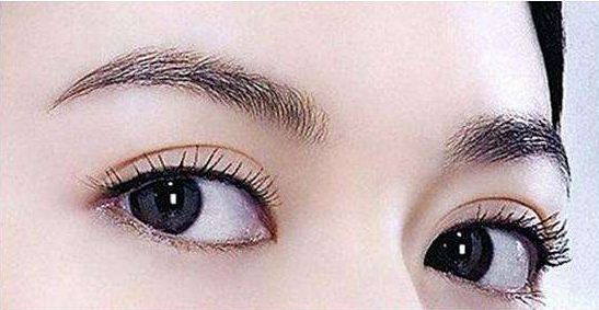 哪家成都醫(yī)院最適合取肉痣？專業(yè)醫(yī)療機構推薦