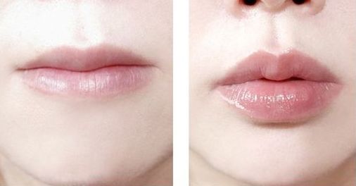 南京哪家醫(yī)院治療黃褐斑效果好？