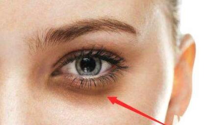 學(xué)會提升面部凹陷吧！病例分享，術(shù)后30天的終極效果。