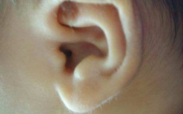 杭州華山程琳整鼻術(shù)態(tài)度與效果亮眼，醫(yī)師傳世之匠藝悅目案例展示