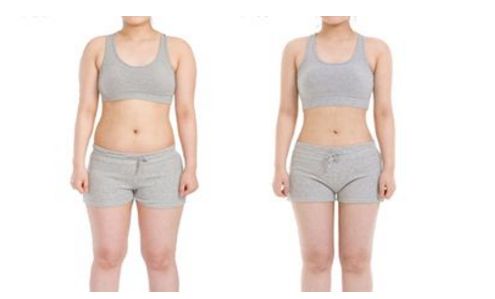 上海哪家醫(yī)院能有效去除妊娠紋，讓肌膚重新恢復緊致？