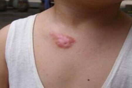 上海切眼袋手術(shù)醫(yī)院排名及口碑如何？