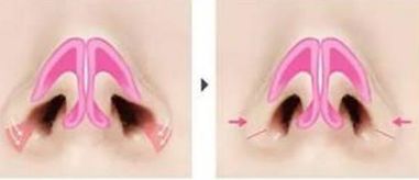 荊州美傲整形醫(yī)院門診有哪些擅長的項(xiàng)目？