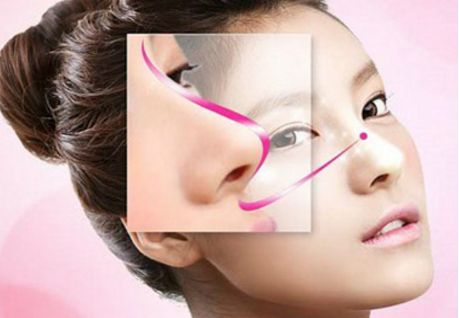 深圳駝峰鼻矯正哪家好？專業(yè)醫(yī)生推薦與真實(shí)案例分享！