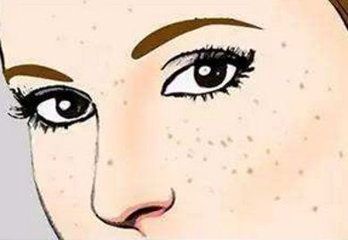 上海范榮杰醫(yī)生鼻部整形案例詳解，效果如何？