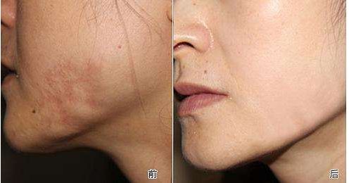 山東哪家整形醫(yī)院口碑好且專業(yè)？