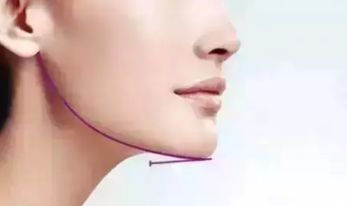 成都醫(yī)美做唇部哪家醫(yī)院好？找到這家醫(yī)院，告別唇部問題的困擾！