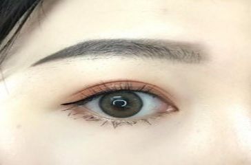 上海去黑眼圈哪個醫(yī)院好？專家推薦的實力醫(yī)院排行榜