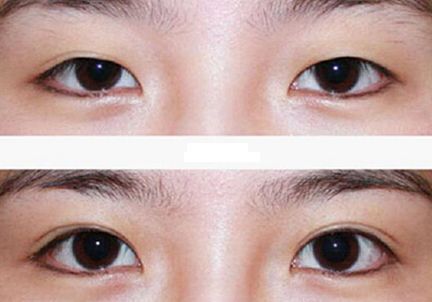 北京哪家激光祛痘醫(yī)院好？選擇正規(guī)醫(yī)療機構(gòu)，實力專家團隊等你來解答