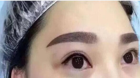 北京史三八整形醫(yī)院李珠賢紋眉口碑評價如何？