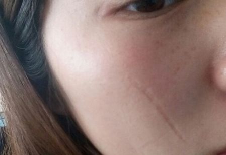 濟(jì)南哪家醫(yī)院做豐胸效果好？排名靠前，技術(shù)專業(yè)的有哪些？