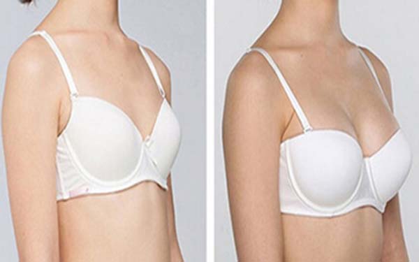 2023珠海提上瞼肌口碑榜前10強的醫(yī)生(王繼紅、金海丹、周輝榜首預(yù)定~)