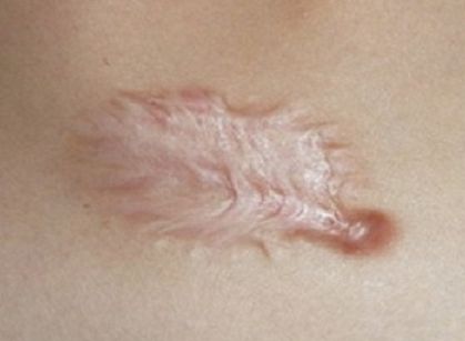 海南去雀斑哪家醫(yī)院好？探尋海南最受歡迎的雀斑祛除醫(yī)療機構(gòu)