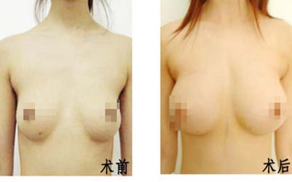 朱海杰鼻部整形效果如何？醫(yī)生評(píng)價(jià)+就診醫(yī)院匯總+價(jià)格信息參考