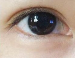 蘇州哪家祛痘醫(yī)院好？專家推薦的治療痘痘效果好的醫(yī)院