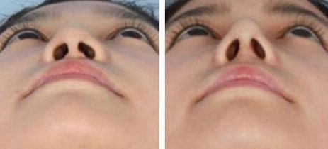 蘭州美容好的醫(yī)院是哪家？挑選最適合你的蘭州美容醫(yī)院