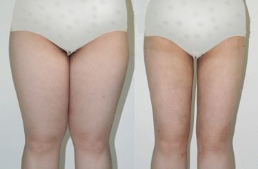 南京雀斑祛除十強診所：專業(yè)技術，效果顯著