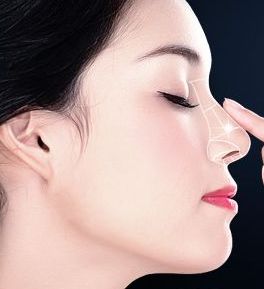 眼袋抽脂手術：整容效果深受好評