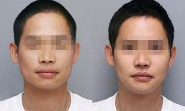 擁有瓜子臉特點的人有哪些？