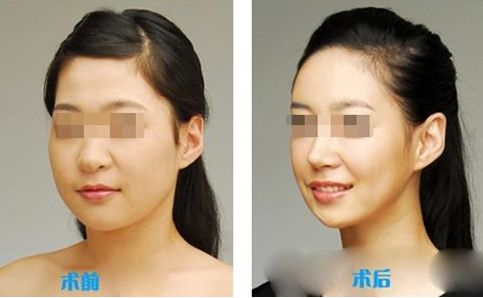 鼻子大小與顏值相關(guān)度到底如何？揭秘其中奧秘