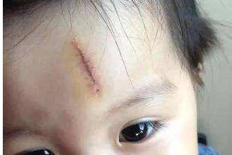 成都哪里做拉皮手術(shù)效果好，八大處、晶膚、嬌點(diǎn)等5家備受推薦
