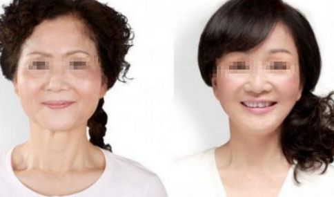 腹部抽脂術(shù)的疼痛感受，了解一下!