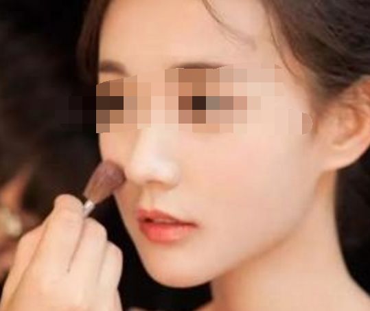 女子臀部整形好風(fēng)險！整形手術(shù)遭不法醫(yī)生用水泥灌注