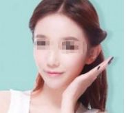 孫儷的容顏?zhàn)兓l(fā)熱議，她真的進(jìn)行了整容嗎？