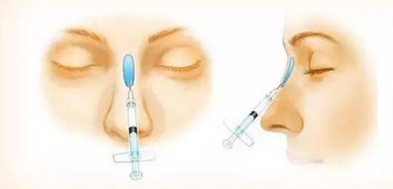 美白祛斑的方法有哪些？4種醫(yī)美美肌方案推薦