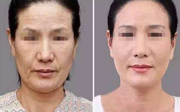 如何讓幼態(tài)臉變得緊致有型？塑造迷人圓潤(rùn)臉型攻略揭秘！