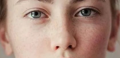 稱贊王博謙割雙眼皮的經(jīng)歷了如何？分亞洲變化發(fā)生，介紹迥異案例