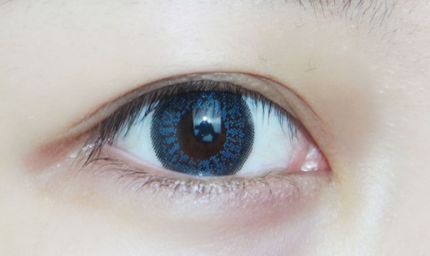 淮南市醫(yī)院有做雙眼皮手術(shù)嗎？手術(shù)技術(shù)如何？價(jià)格如何？實(shí)例解析給您參考