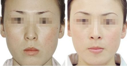 衡陽雅美開啟逆齡狂歡，網(wǎng)紅臉、幼態(tài)臉任你選