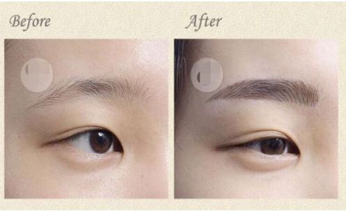 成都華西口腔種植牙費(fèi)用一覽表出爐！想了解非常受歡迎的五位醫(yī)生？