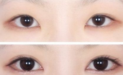 南京中醫(yī)院優(yōu)秀雙眼皮專家推薦，值得信賴！完善的醫(yī)生介紹、項(xiàng)目介紹及價格表供參考