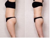 深圳出現(xiàn)最佳眼部整形醫(yī)院排行榜！搶先查看你鐘情的醫(yī)療機構(gòu)排名情況