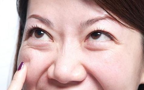 上海九院去眼袋專家推薦，最全擅長(zhǎng)項(xiàng)目及費(fèi)用一覽