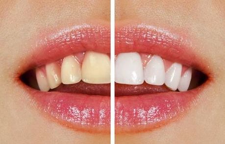 榆林市第一醫(yī)院最牛眼科專家曝光！秒懂近視眼手術(shù)真相