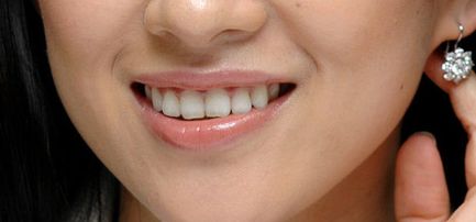 探尋西安藝星宋蔚雙眼皮技術(shù)，深度解析醫(yī)生實(shí)力與經(jīng)典案例分享