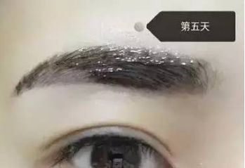 南昌美伊爾劉立軍醫(yī)生膨體隆鼻整形費用？手術效果如何？帶您看醫(yī)生案例