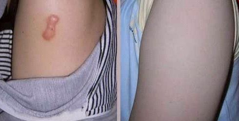 天津河?xùn)|美萊醫(yī)學(xué)醫(yī)院受推崇的全雙醫(yī)生吸脂術(shù)是否靠譜？