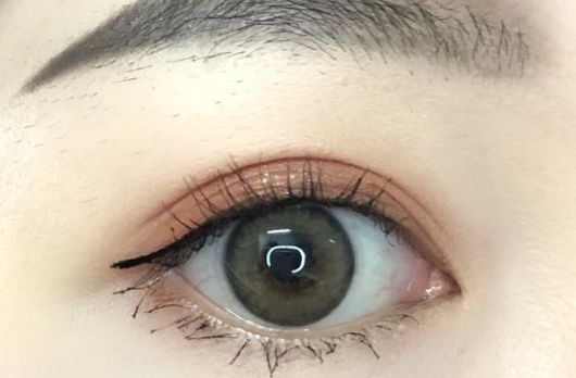 深圳保麗圣瑞整形醫(yī)院面部脂肪填充2023案例分享，效果好嗎？