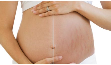 柳大烈的下頜角磨骨手術(shù)：醫(yī)生實力揭秘及成功案例分享